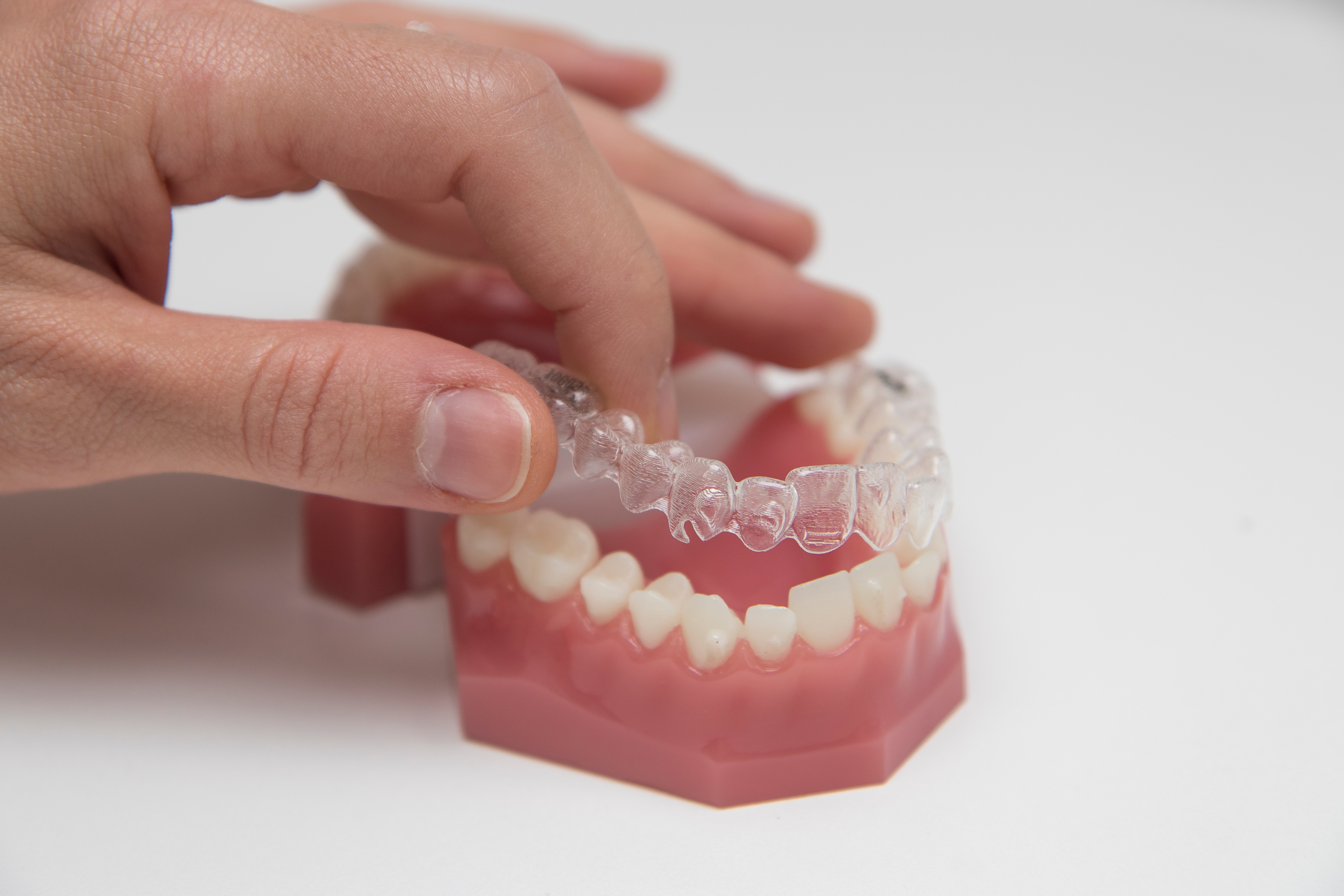 Clear Aligner Dentist London