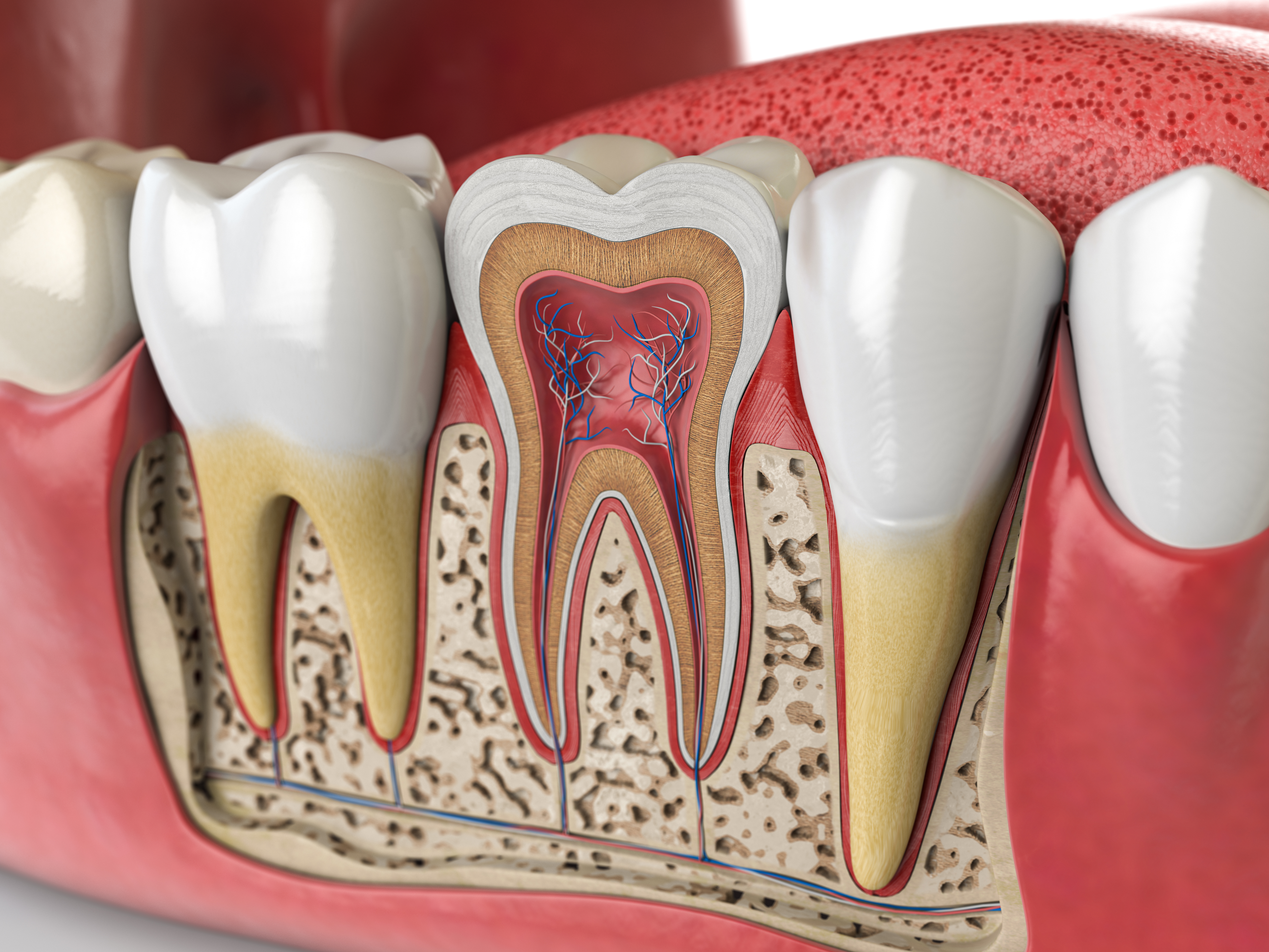 Root canal treatment at DentAkademi London