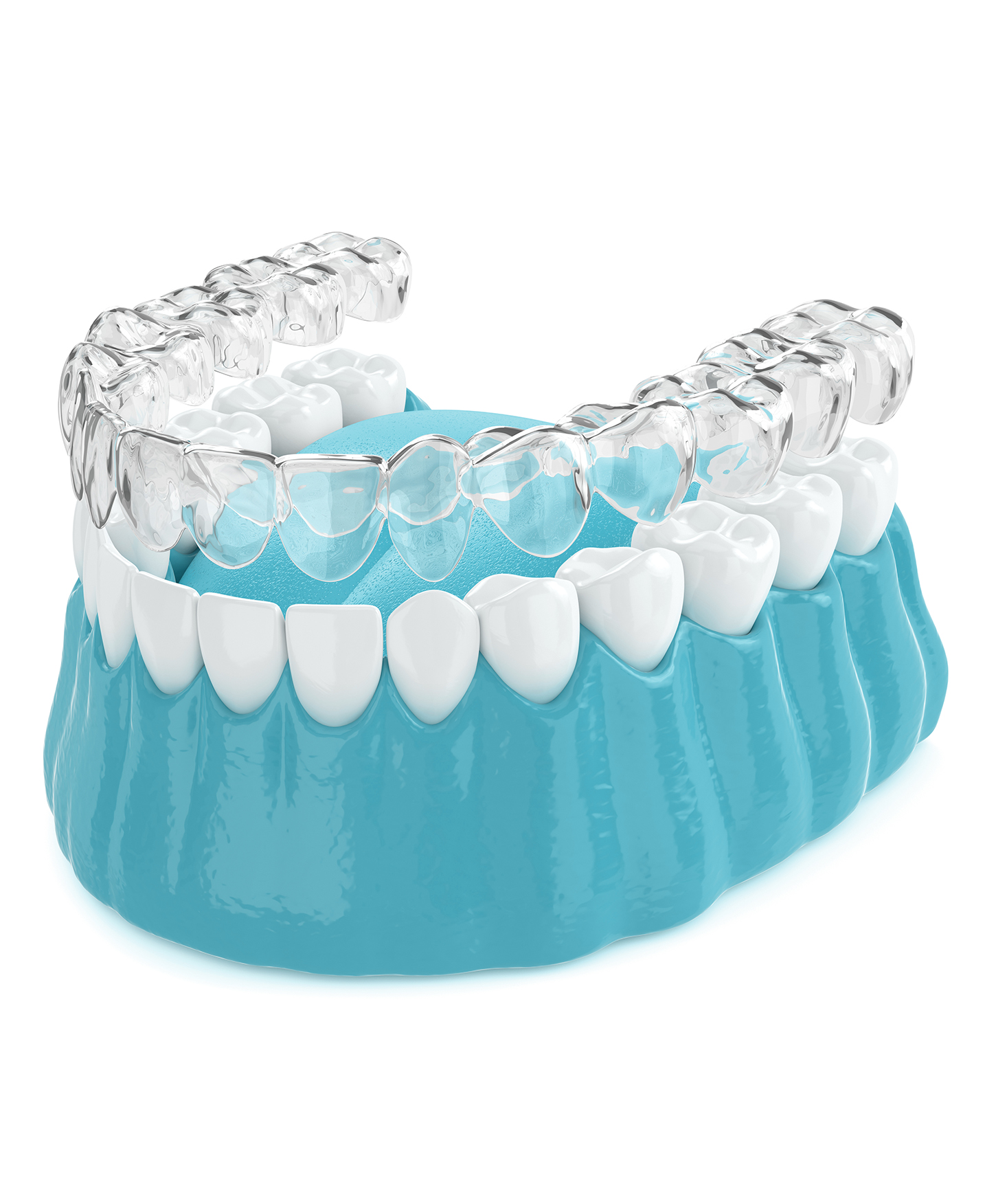 Gum Shield and Night Guard at DentAkademi London