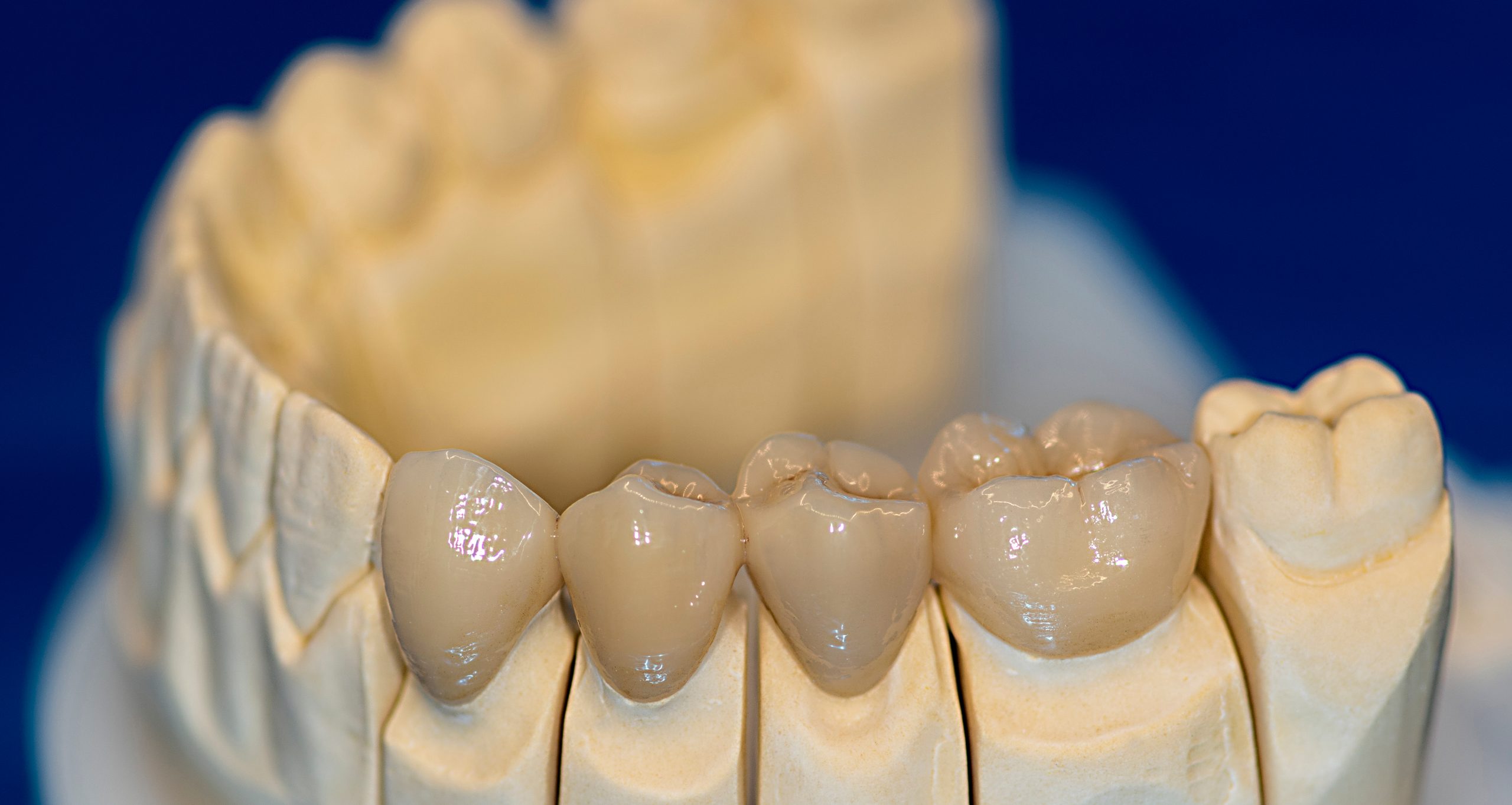 Dental Crown Cost UK
