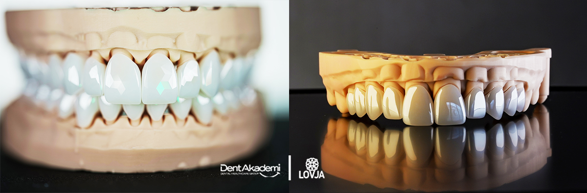 Lovja Smile Design — DentAkademi