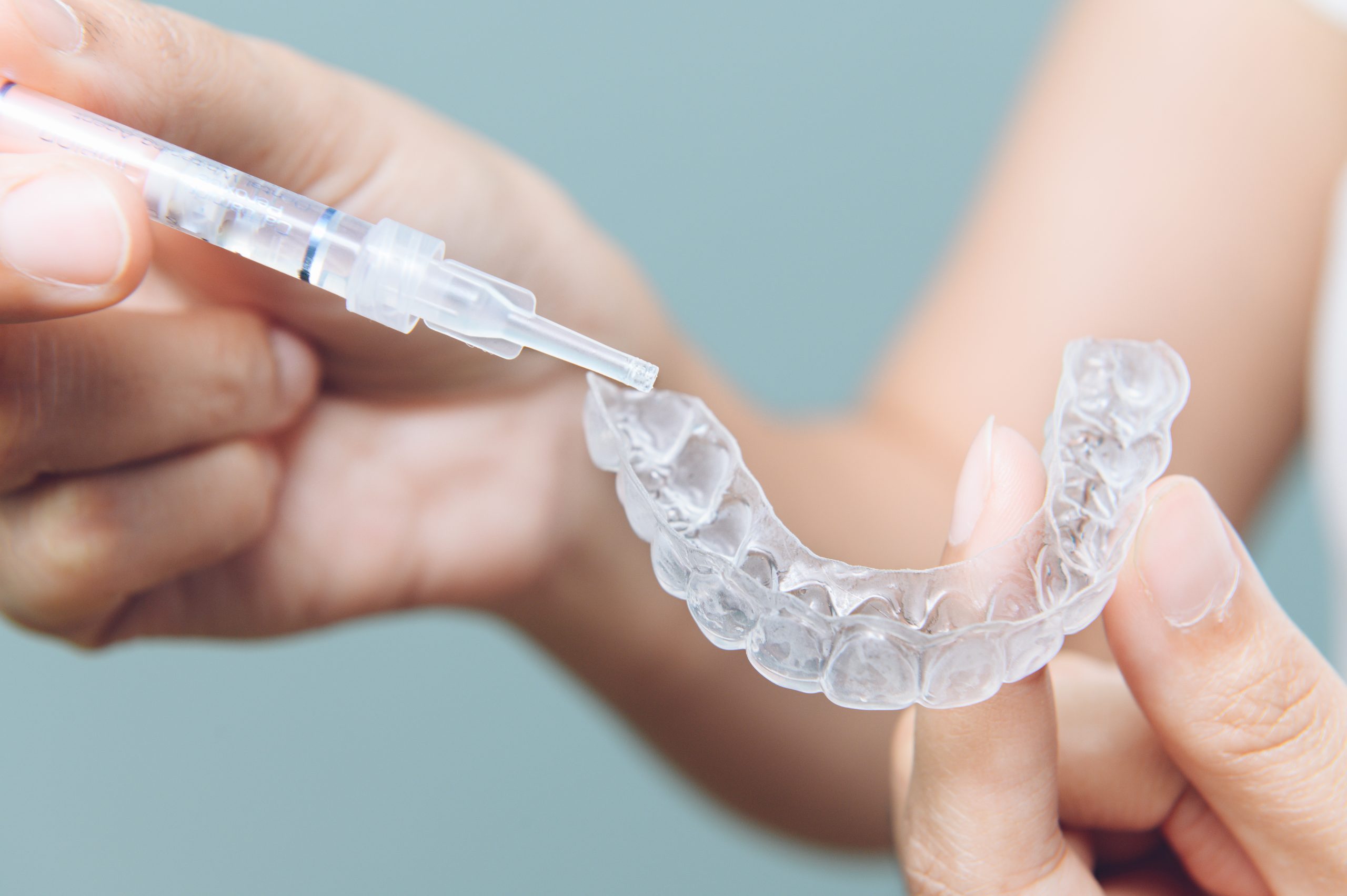 Professional Teeth Whitening vs Home Whitening Kits