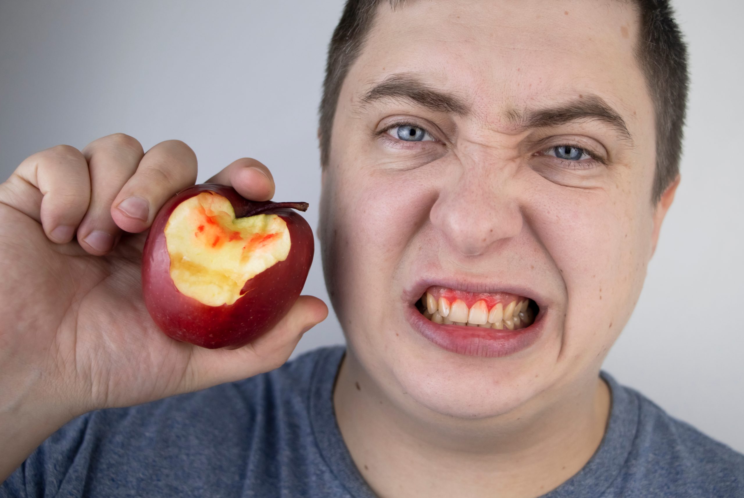 Gum Disease Treatment London